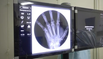 Рентген-аппарат стоимостью около 20 миллионов рублей получила больница на Камчатке