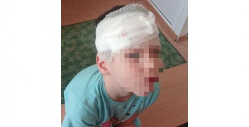 Серьезную травму получил воспитанник детского сада в Петропавловске-Камчатском 0